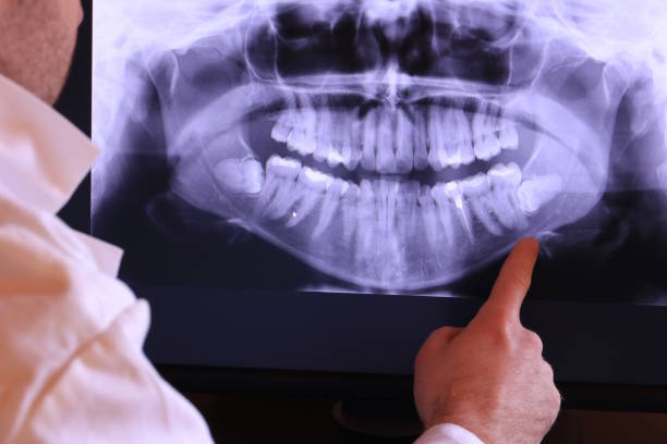 Dentist for Dental Trauma in WA